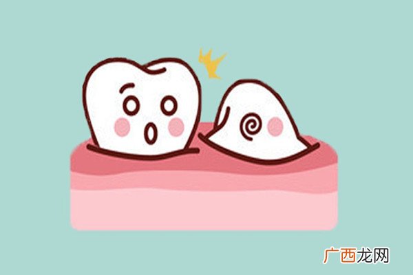 女子拔智齿生拉硬拽摇晃1小时-智齿是必须要拔掉吗