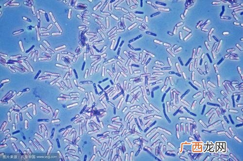 水产芽孢杆菌使用注意 水产芽孢杆菌能降碱吗