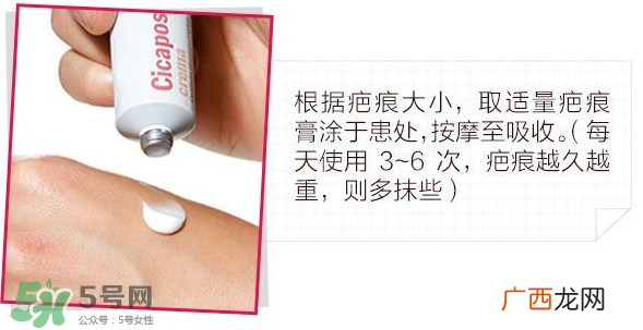 Isdin怡思丁去疤痕膏怎么样？Isdin怡思丁去疤痕膏有效吗？