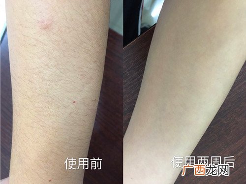 silkpro脱毛仪效果怎么样？