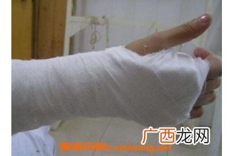 八仙接骨宝的配方与功效