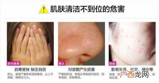 下巴上长痘痘是什么原因引起的（脸部长痘对应