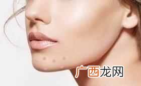 下巴上长痘痘是什么原因引起的（脸部长痘对应