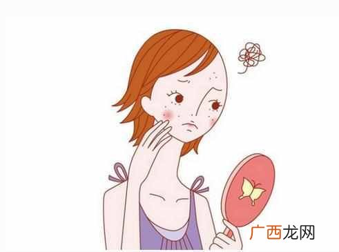 下巴上长痘痘是什么原因引起的（脸部长痘对应