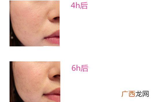 兰蔻奇迹薄纱粉底液使用测评怎么样