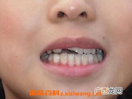 嘴上上火起泡怎么办 嘴上上火吃什么好