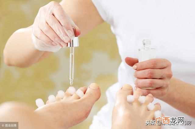 推荐几款最有效的药 灰指甲用什么药根除