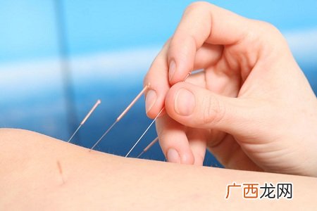 针灸有效治疗腰间盘突出病症