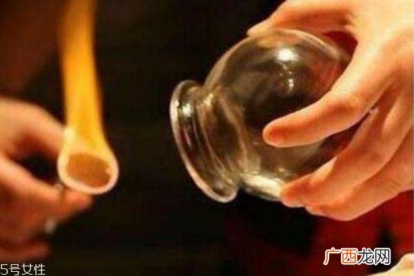 肚子减肥拔罐子拔哪个穴位