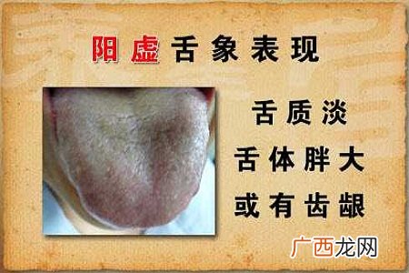 中医阳虚体质应该如何进行有效调养?