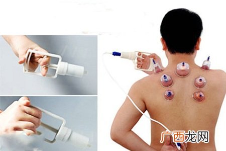 拔火罐能治疗感冒吗?需要注意什么?