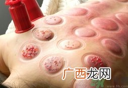 拔火罐可以去湿气吗?拔火罐能去除体内湿气吗?