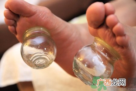 脚底可以拔罐吗？脚底拔火罐有什么好处？
