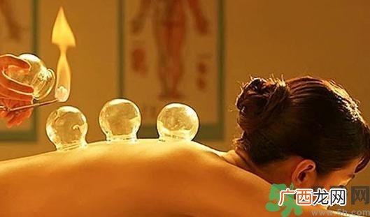 在家拔罐需要注意什么？在家拔罐几天拔一次？