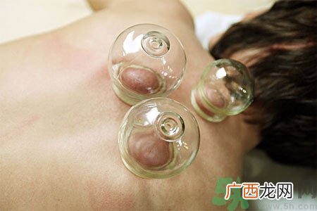 月经可以拔火罐吗？经期可以拔火罐吗？