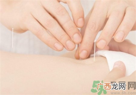 针灸后能洗澡吗?针灸后多久可以洗澡?