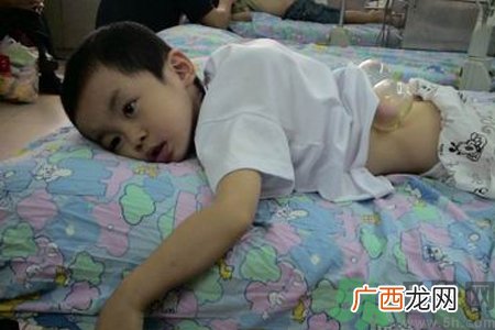 小孩可以拔罐吗？宝宝能拔火罐吗？
