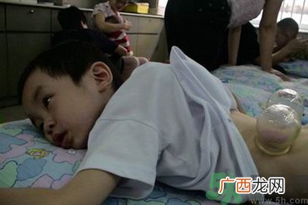 小孩可以拔罐吗？宝宝能拔火罐吗？