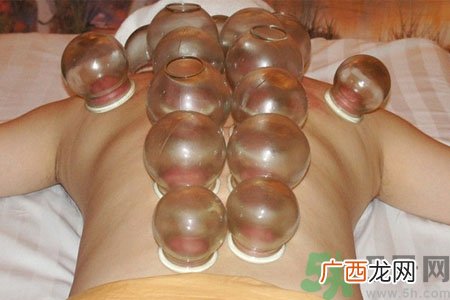 老人能在家拔火罐吗？老年人拔火罐需要注意什么？