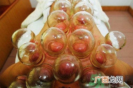 老人能在家拔火罐吗？老年人拔火罐需要注意什么？