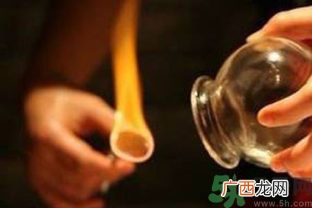 老人能在家拔火罐吗？老年人拔火罐需要注意什么？