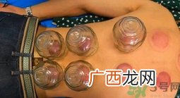 拔罐后罐印颜色越深代表什么?