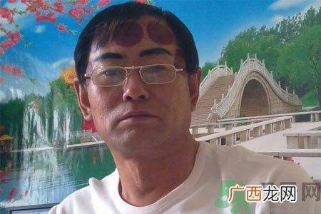 头痛可以在额头上拔火罐吗？额头上拔火罐有什么好处？