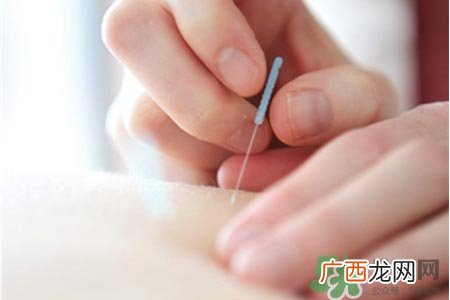 腰间盘突出可以针灸吗？针灸能治腰间盘突出吗？