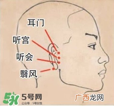 艾灸治疗耳鸣操作方法艾灸治疗耳鸣视频