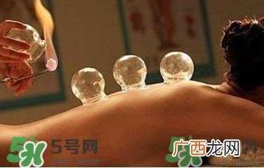 拔火罐疼吗？拔火罐疼不疼
