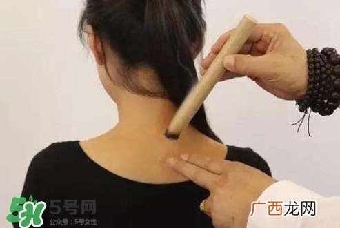 颈椎疼艾灸哪里?艾灸颈椎视频教程
