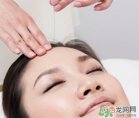 针灸到底疼不疼啊?针灸最适合哪些病
