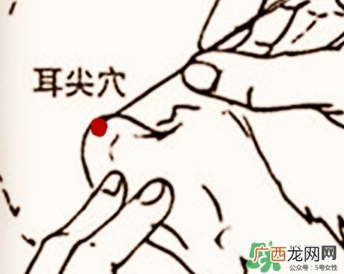 什么人不能做放血疗法?放血疗法有什么功效?