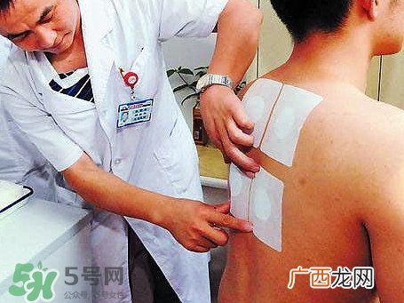 三伏灸可以治疗什么病?三伏灸与艾灸有什么区别