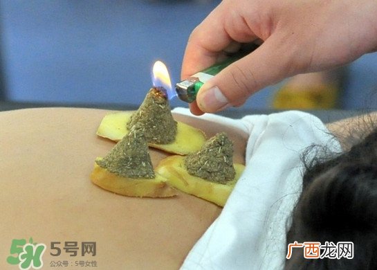 三伏灸灸哪里？三伏灸是每天都灸吗