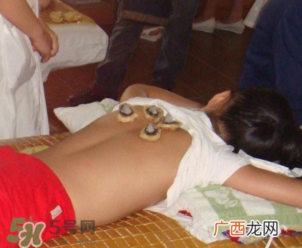 三伏灸有什么作用?三伏灸不能吃什么