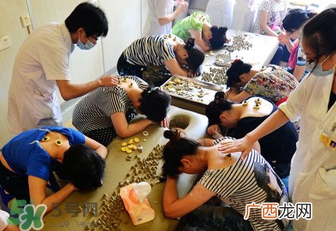三伏灸有什么作用?三伏灸不能吃什么