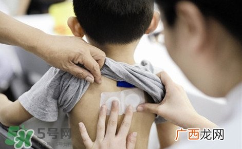 三伏灸有什么作用?三伏灸不能吃什么