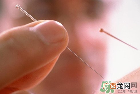 针灸可以治疗失眠吗？失眠时针灸哪些穴位有效