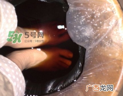 醋泡脚用白醋还是陈醋？泡脚用什么醋最好？