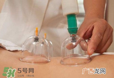 真空拔罐有用吗?真空拔罐多长时间合适