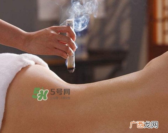 艾灸器具哪种好?艾灸后皮肤极痒为什么