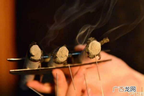 什么是三九灸三九灸的好处与功效