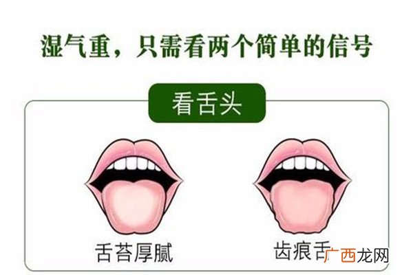湿气重的舌苔是什么样的湿气重的舌苔表现