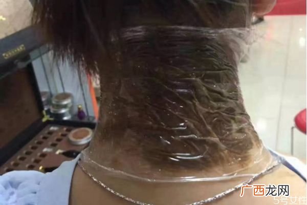 富贵包有什么危害富贵包对身体的伤害