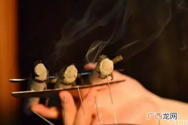 艾灸肚脐眼的功效艾灸肚脐眼的时间