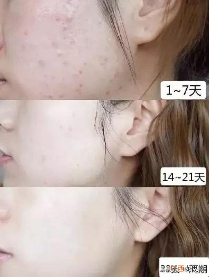 有种整容叫方媛卸妆 方媛整容前后