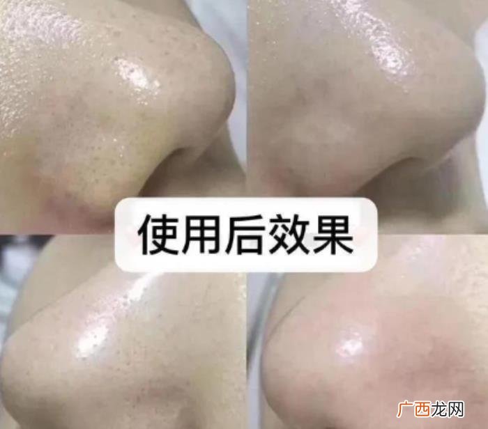 有种整容叫方媛卸妆 方媛整容前后