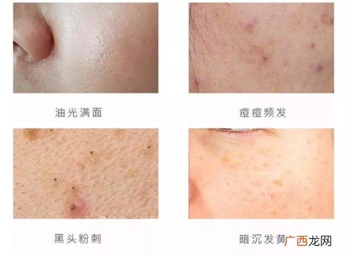 有种整容叫方媛卸妆 方媛整容前后