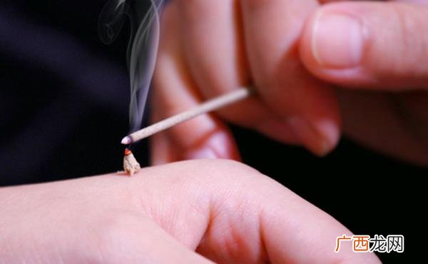 哪些人群不适合艾炙这8类人要慎重